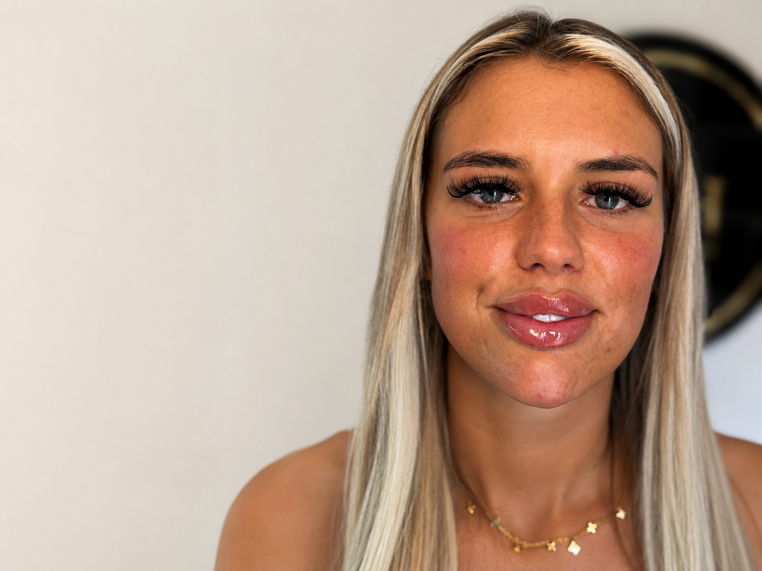 Lip Filler in Hartlepool: What to Expect from Your Treatment