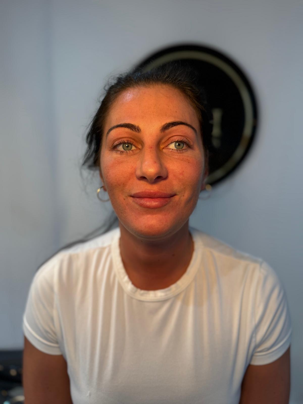 Advanced skin rejuvenation at HCH Aesthetics