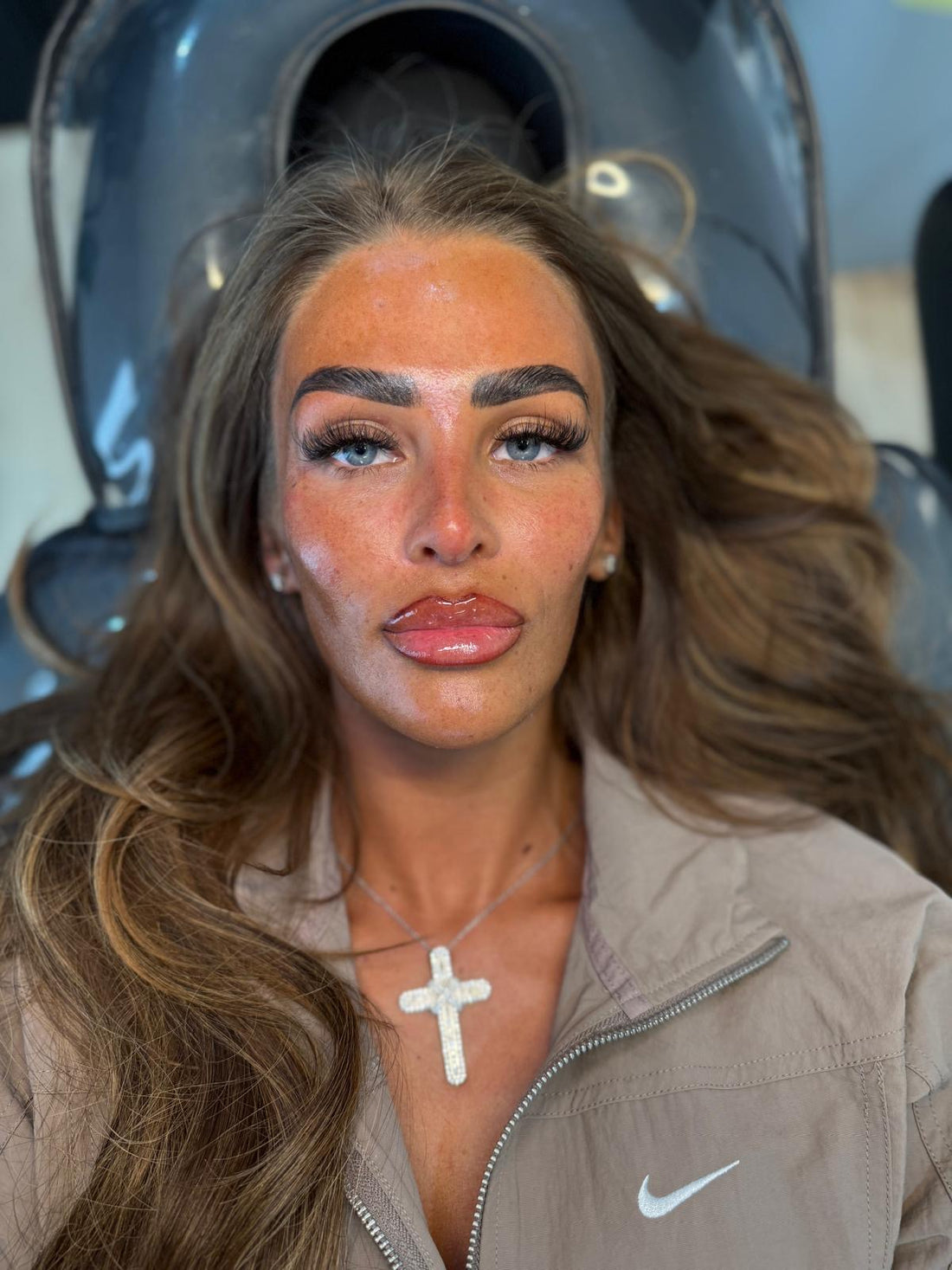 After HCH Aesthetics treatment