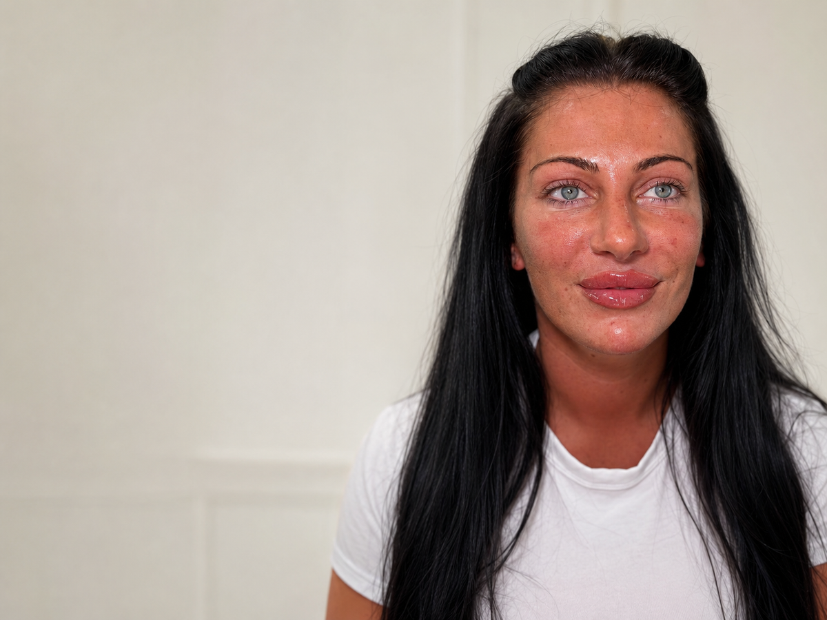 Skin rejuvenation treatment at HCH Aesthetics