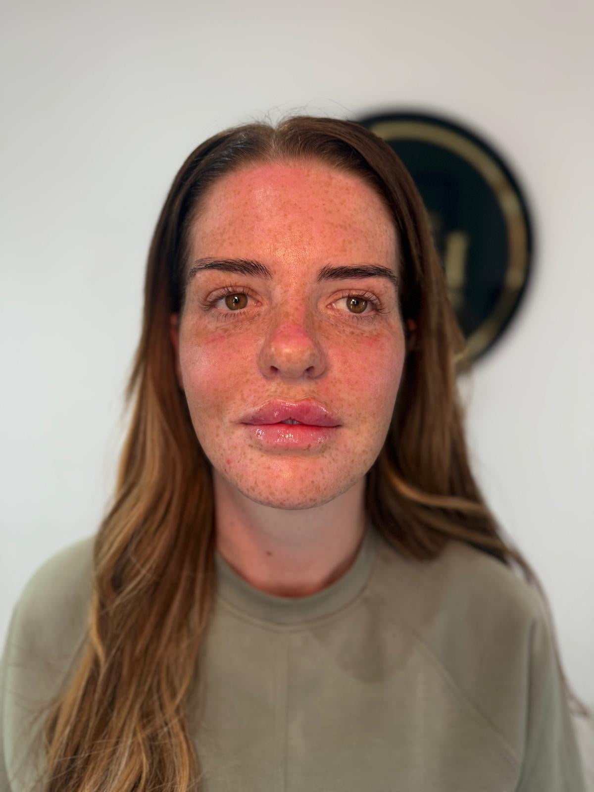 Personalised skin assessment at HCH Aesthetics