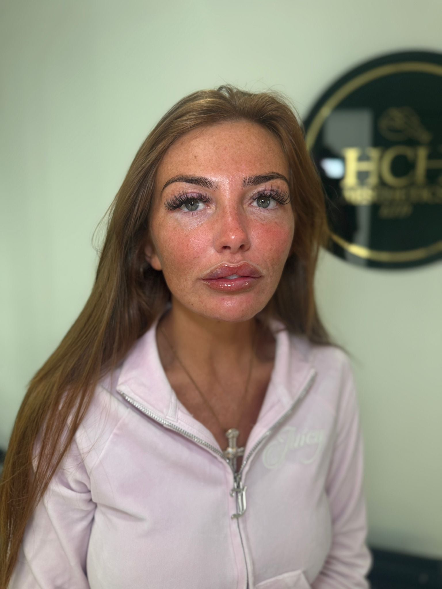HCH Aesthetics considered treatment experience
