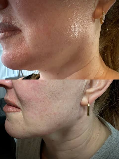 Personalised body contouring consultation at HCH Aesthetics